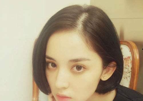 有哪些明星脱发,盘点那些勇敢面对脱发的明星