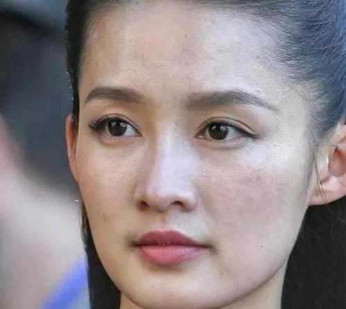 哪些明星皮肤差,揭秘皮肤状况不佳的明星护肤之路